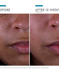 SkinCeuticals Silymarin CF 30ml SkinCeuticals