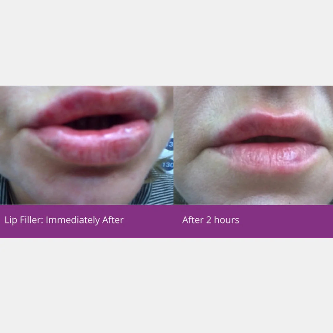 Cebelia LCE Balm 15ml