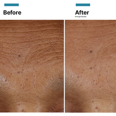 Skinceuticals Plumping & Anti-Ageing Power Pair Ha Intensifier Multi Glycan 30ml + P-TIOX 30ml