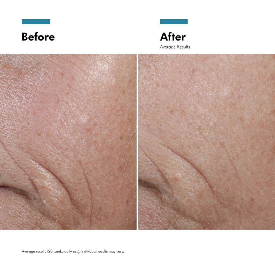 SkinCeuticals Skin Renewal Bundle
