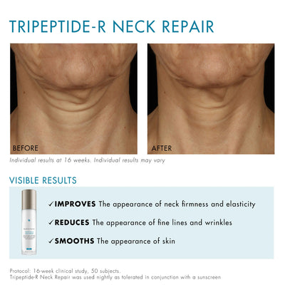 SkinCeuticals Tripeptide-R Neck Repair 50ml