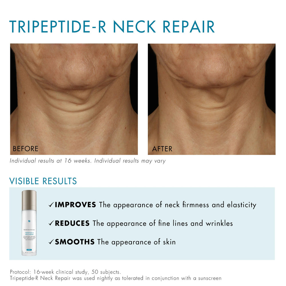 SkinCeuticals Tripeptide-R Neck Repair 50ml SkinCeuticals