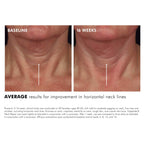 SkinCeuticals Tripeptide-R Neck Repair 50ml SkinCeuticals