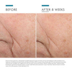 SkinCeuticals Triple Lipid Restore 2:4:2 Moisturiser 48ml SkinCeuticals