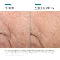 SkinCeuticals Triple Lipid Restore 2:4:2 Moisturiser 48ml SkinCeuticals