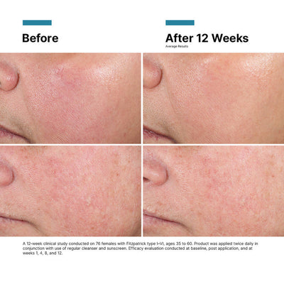 Skinceuticals Advanced RGN-6 50ml