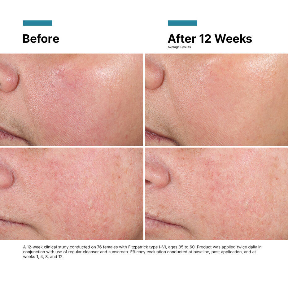 SkinCeuticals Advanced RGN-6 50ml Moisturiser and Lotions