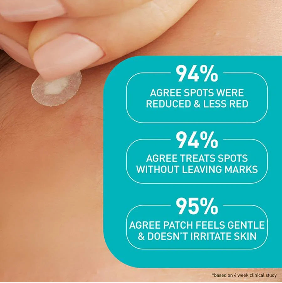 CeraVe Blemish Barrier Patches - 22
