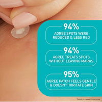 CeraVe Blemish Barrier Patches - 22