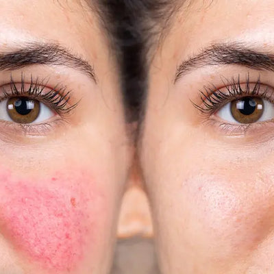 SkinCeuticals Redness Neutralizer 50ml