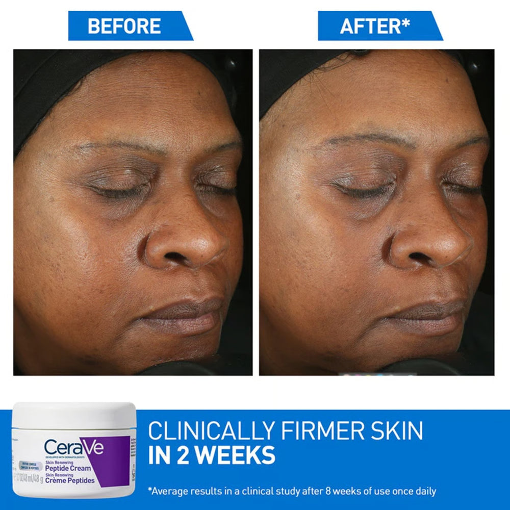CeraVe Skin Renewing Night Cream 48ml