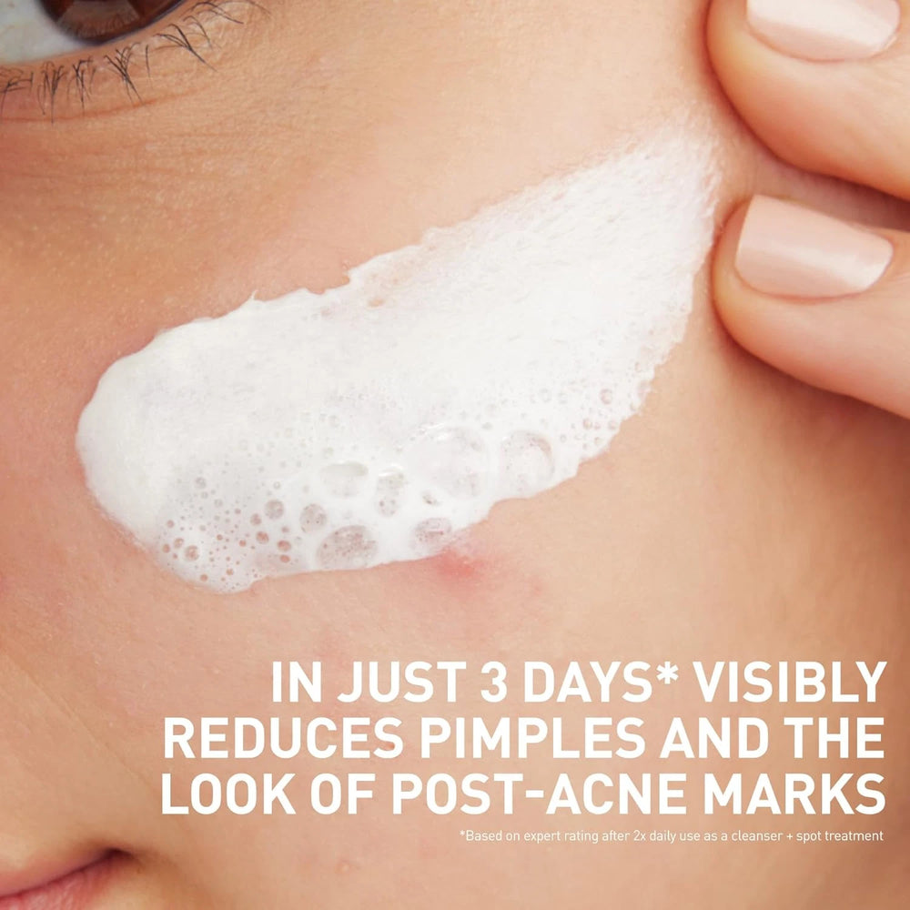 CeraVe Blemish Clay To Foam Cleanser 118ml