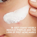 CeraVe Blemish Clay To Foam Cleanser 118ml