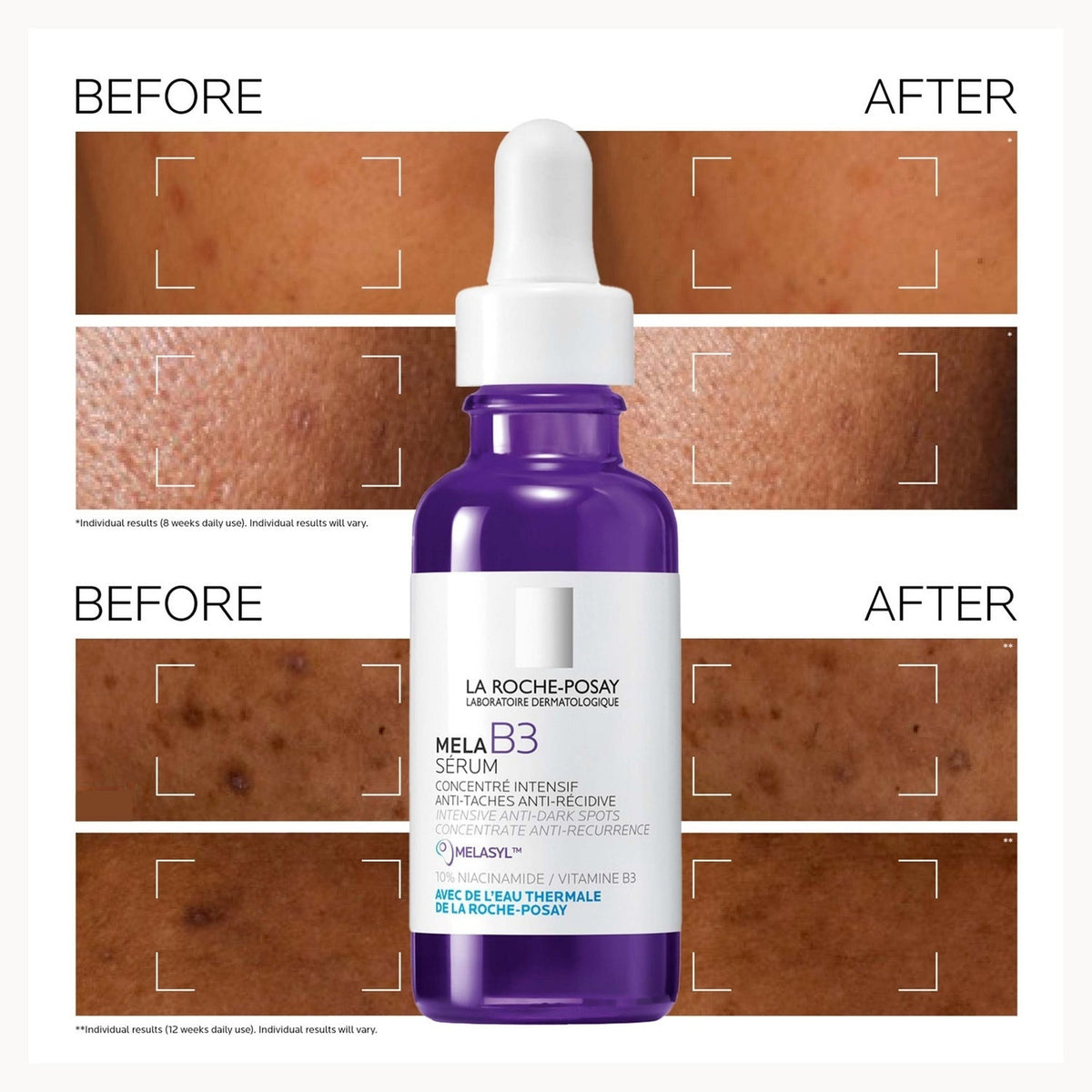 La Roche-Posay Mela B3 Serum 50ml