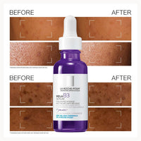 La Roche-Posay Mela B3 Serum 50ml
