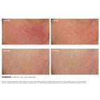 SkinCeuticals Glycolic 10 Renew Overnight 50ml SkinCeuticals