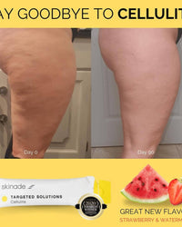 theskinbay.co.uk Skinade Targeted Solutions Cellulite 90 Day Supply Skinade Cellulite Skincare
