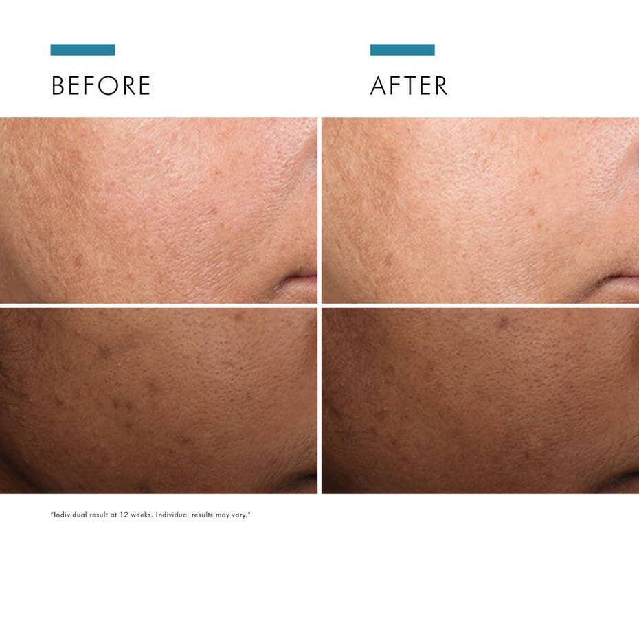 SkinCeuticals discoloration defense 2024