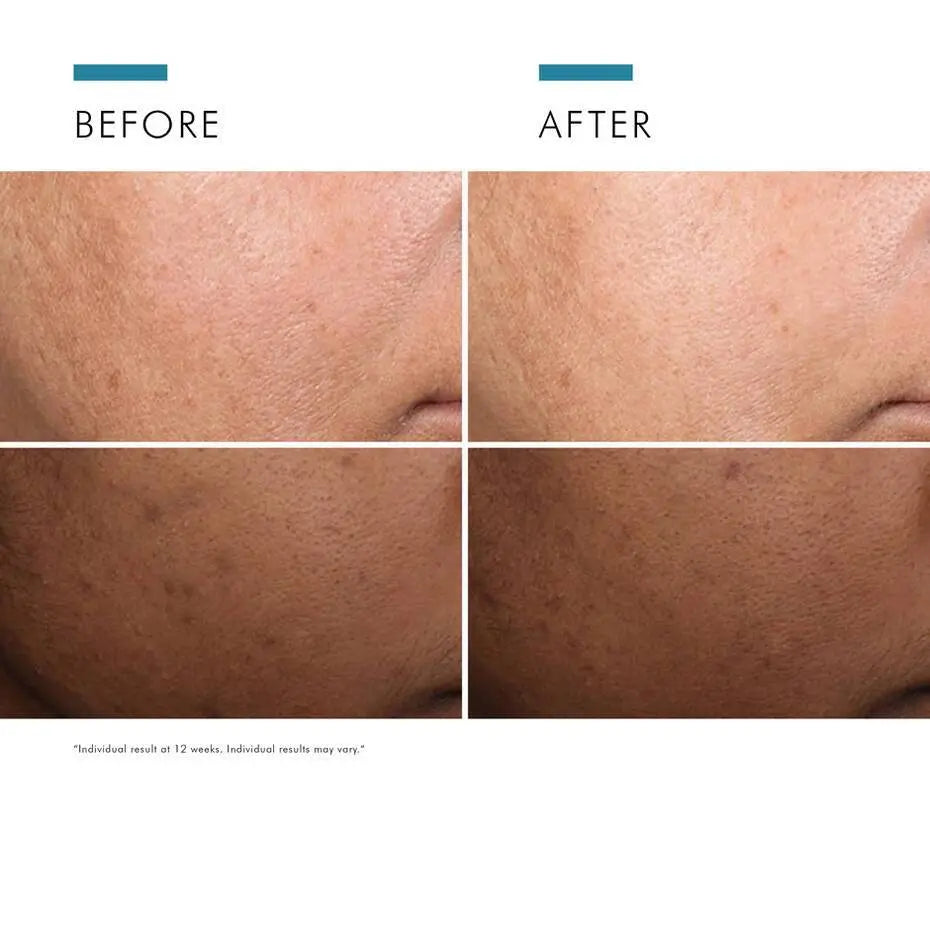 theskinbay.co.uk SkinCeuticals Discoloration Defense Serum 30ml SkinCeuticals Ageing Skin Discoloration Hyperpigmentation Menopause Mens Skincare Sun Damaged Uneven Skin Tone