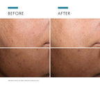 theskinbay.co.uk SkinCeuticals Discoloration Defense Serum 30ml SkinCeuticals Ageing Skin Discoloration Hyperpigmentation Menopause Mens Skincare Sun Damaged Uneven Skin Tone