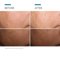 theskinbay.co.uk SkinCeuticals Discoloration Defense Serum 30ml SkinCeuticals Ageing Skin Discoloration Hyperpigmentation Menopause Mens Skincare Sun Damaged Uneven Skin Tone