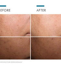 theskinbay.co.uk SkinCeuticals Discoloration Defense Serum 30ml SkinCeuticals Ageing Skin Discoloration Hyperpigmentation Menopause Mens Skincare Sun Damaged Uneven Skin Tone