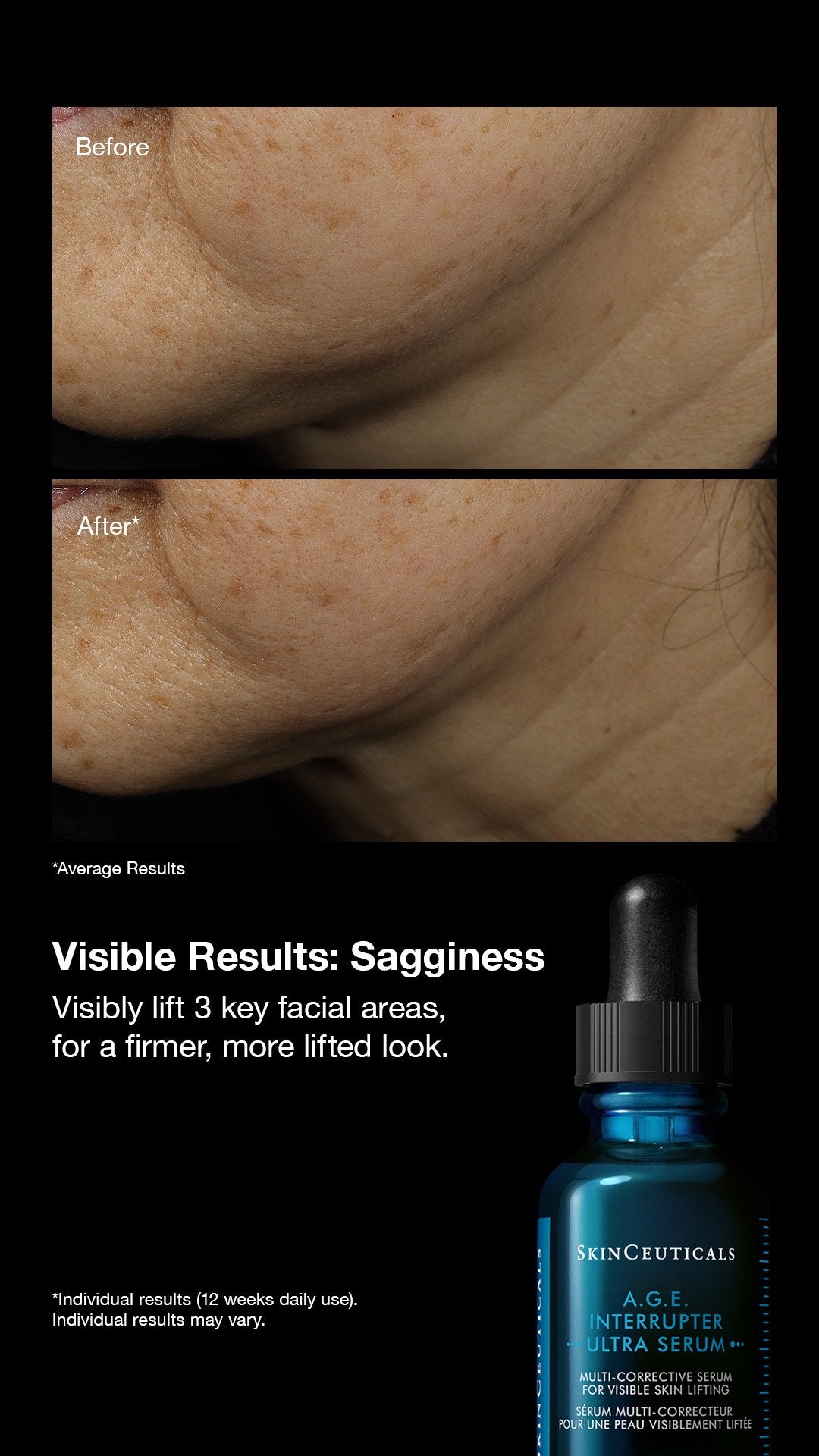 {{Product vendor}} {{Product title}}  Serum